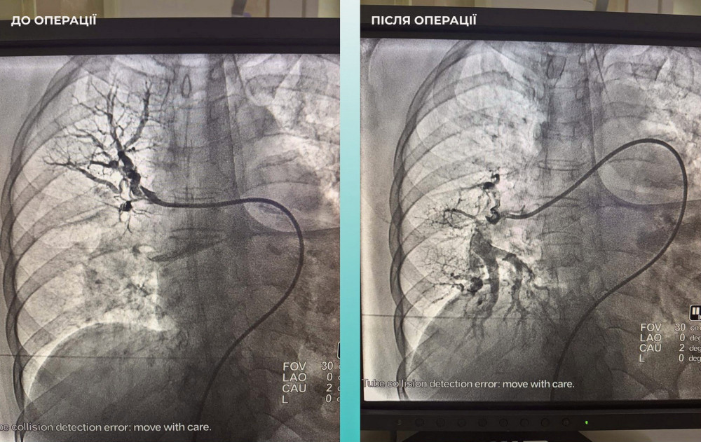 17409 image for slide