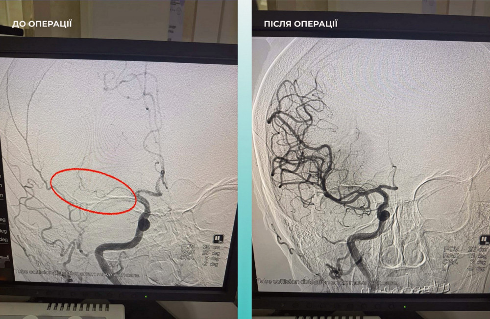 17411 image for slide